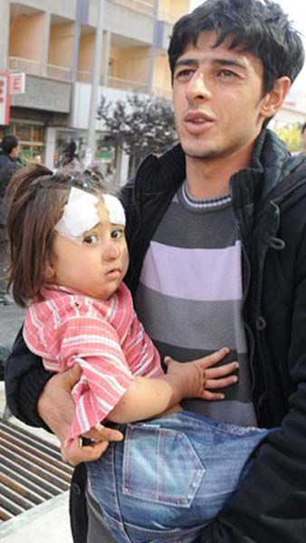A man carries an injured child in the city of...