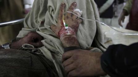 A man holds a hand of his injured family member at a local hospital for treatment in Peshawar, Pakistan on Thursday, Feb. 14, 2013.