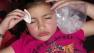A San Francisco mother is drawing criticism for giving Botox injections to her 8-year-old daughter.