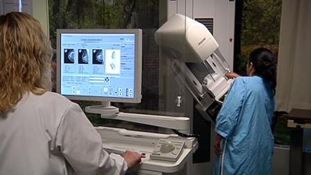 Breast cancer report sparks new worries in Bay Area