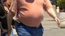 Obese person walking