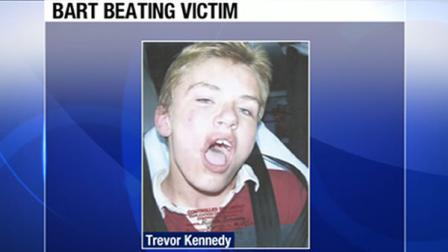 Trevor Kennedy