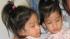 Conjoined twins successfully separated :: Angelina and Angelica Sabuco