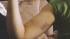 Prosecution: Photos show bruises Mirkarimi gave...
