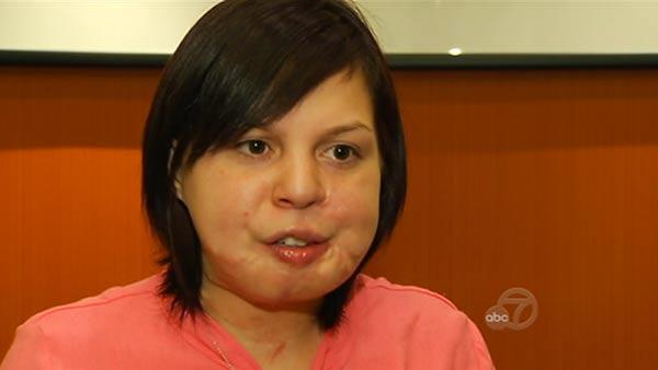 Woman who survived being shot in face speaks about teen dating