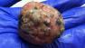 Dog in San Francisco sickened after eating poisoned meatball