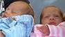 Twin having twins reunites Kaiser patients, staff
