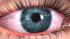 Beyond the Headlines: Vision Impairment ::