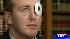Woodlands man left blind in one eye following... ::