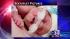 Photos of the  Perkins sextuplets
