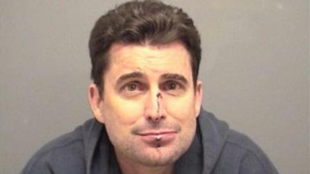 A police mug shot of Rob Morrison shows him with what appear to be a bloody cut on the bridge of his nose and a nasty bruise on his swollen bottom lip.