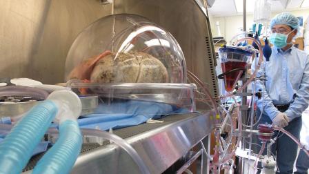 Lungs donated as part of research at the University of North Carolina, Chapel Hill, sit inside a machine as theyre ventilated and tested