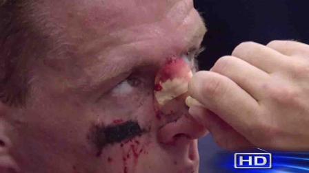 J.J. Watt, bloodied and bruised after busting the bridge of his nose while tackling the Seahawks quarterback