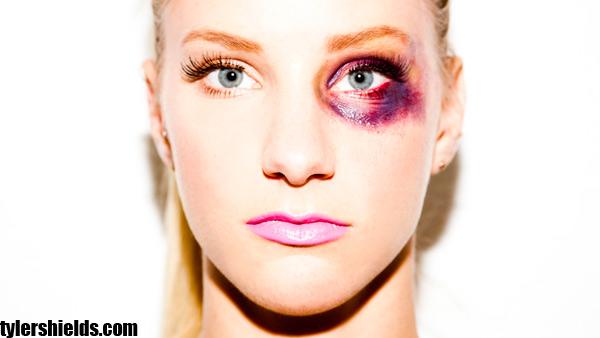 Heather Morris appears in a 2011 photo by Tyler Shields. - Provided courtesy of TylerShields.com Heather Morris appears in a 2011 photo by Tyler Shields. - Provided courtesy of TylerShields.com