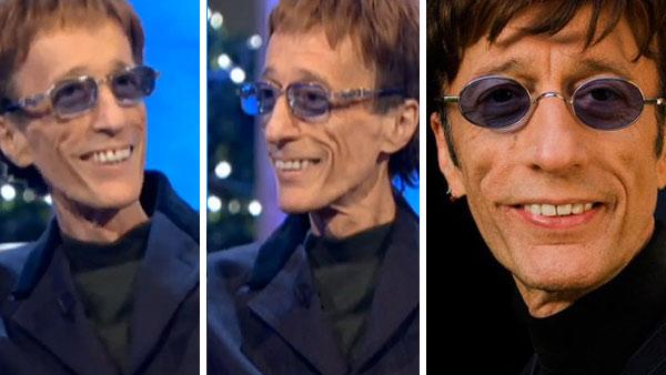 Robin Gibb of The Bee Gees appears on ITVs Alan Titchmarsh Show on Oct. 24, 2011. / Robin Gibb appears in a photo posted on his Facebook page on Oct. 7, 2010. - Provided courtesy of OTRC / ITV / facebook.com/pages/Robin-Gibb/28951845275 Robin Gibb of The Bee Gees appears on ITVs Alan Titchmarsh Show on Oct. 24, 2011. / Robin Gibb appears in a photo posted on his Facebook page on Oct. 7, 2010. - Provided courtesy of OTRC / ITV / facebook.com/pages/Robin-Gibb/28951845275