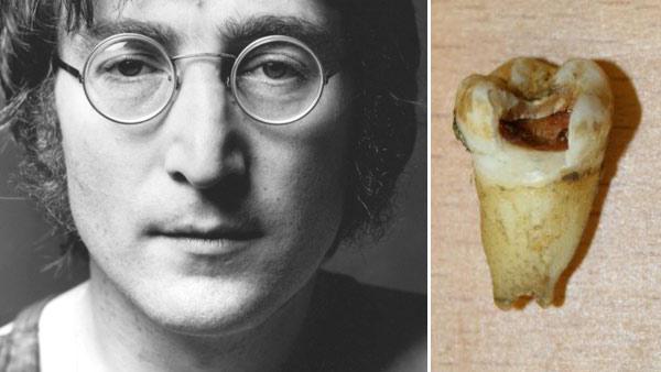 John Lennon appears in an undated photo from his official website. / John Lennons molar appears in a photo from Omega Auctions. - Provided courtesy of JohnLennon.com / OmegaAuctions.com John Lennon appears in an undated photo from his official website. / John Lennons molar appears in a photo from Omega Auctions. - Provided courtesy of JohnLennon.com / OmegaAuctions.com