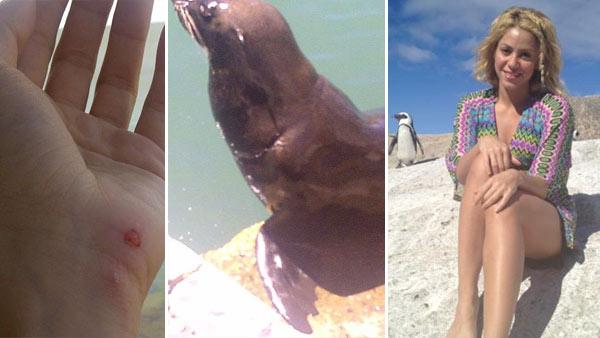 Shakira shows her injured hand. / A sea lion appears in a photo posted by Shakira on Feb. 11, 2012. / Shakira appears in a photo taken in South Africa, posted on her Facebook page on Feb. 11, 2012. - Provided courtesy of facebook.com/shakira Shakira shows her injured hand. / A sea lion appears in a photo posted by Shakira on Feb. 11, 2012. / Shakira appears in a photo taken in South Africa, posted on her Facebook page on Feb. 11, 2012. - Provided courtesy of facebook.com/shakira