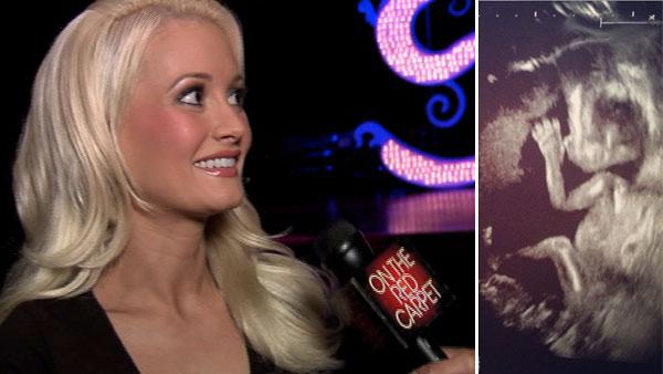 Holly Madison gives OTRC.com a behind the scenes sneak peek of her Vegas show, Peep Show in June, 2010. / Holly Madisons baby appears in a sonogram posted on boyfriend Pasquale Rotellas official Instagram account on October 16, 2012. - Provided courtesy of OTRC / http://instagram.com/p/Q2rGOqh_3B/ Holly Madison gives OTRC.com a behind the scenes sneak peek of her Vegas show, Peep Show in June, 2010. / Holly Madisons baby appears in a sonogram posted on boyfriend Pasquale Rotellas official Instagram account on October 16, 2012. - Provided courtesy of OTRC / http://instagram.com/p/Q2rGOqh_3B/