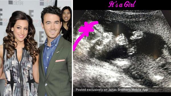 Kevin Jonas and his wife Danielle appear at E! Networks 2013 Upfront on April 22, 2013. / A sonogram of the Jonas baby girl posted on their Instagram accounts on Aug. 29, 2013. - Provided courtesy of Bill Davila/startraksphoto.com / Instagram.com/kevinjonas Kevin Jonas and his wife Danielle appear at E! Networks 2013 Upfront on April 22, 2013. / A sonogram of the Jonas baby girl posted on their Instagram accounts on Aug. 29, 2013. - Provided courtesy of Bill Davila/startraksphoto.com / Instagram.com/kevinjonas