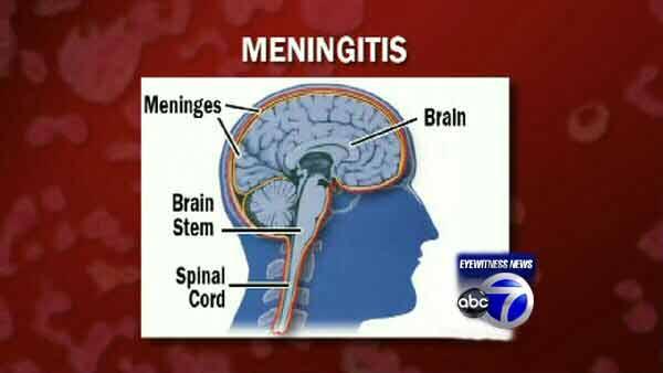 Graphic of how meningitis affects humans