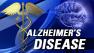 alzheimers disease