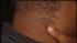 Hate crime slashing victim speaks out ::