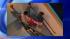 Patients evacuated from Bellevue Hospital due... ::