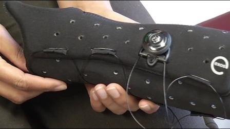Say good-bye to that old, stinky, itchy, bacteria ridden traditional cast and hello to Exos.