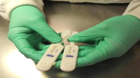 Self-testing for HIV is done at home by collecting samples from the gum lining of the mouth.