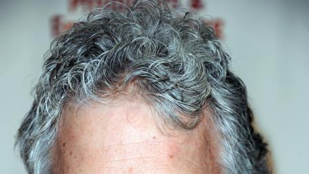 File image of gray hair (Photo by Richard Shotwell/Invision/AP)