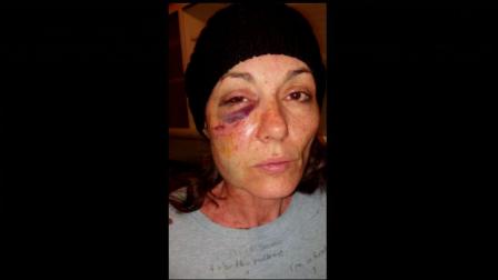 A Chicago woman is suing suburban Skokie and one of its police officers, claiming the officer used unnecessary force during an arrest.