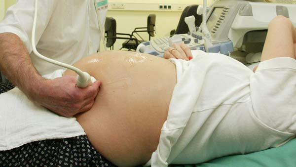 FILE-- An expectant mother gets an ultrasound. (AP)