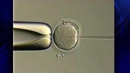 This undated file photo shows an in vitro fertilization treatment.