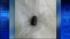 bullet in head