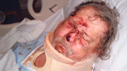 Suspects in Olney beating caught on camera