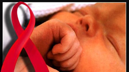 HIV baby