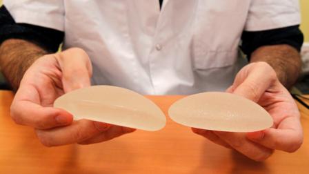 Dr. Maurice Mimoun, a plastic surgeon at the St Louis hospital, holds silicone gel breast implants made by French company Poly Implant Prothese, or PIP, that he removed from a patient because of concerns that they are unsafe, Paris, Wednesday, Dec. 21, 2011. French health authorities are considering whether to suggest that an estimated 30,000 women in France get their breast implants removed, amid warnings by leading doctors about risks of rupture and possible cancer risks.