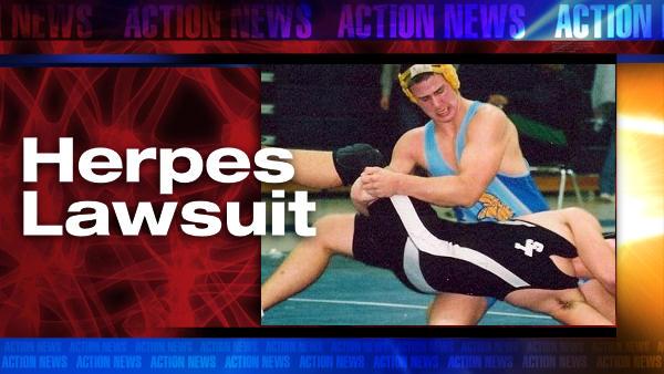 Herpes Lawsuit