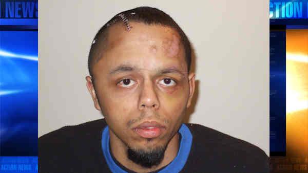 In this March 2009 photo released by Joel H. Merow, Francis Nunez is shown with injuries sustained March 14, 2009 when he was placed under arrest by police officer in Reading Pa.. (AP Photo/Joel H. Merow)