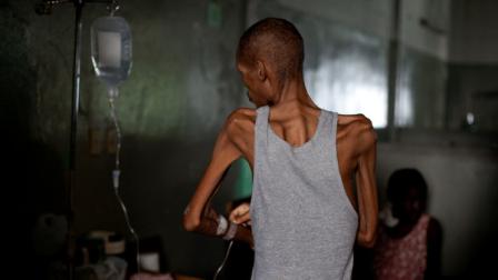 In this photo taken July 9, 2010, a patient stands as he adjusts his intravenous line at the State University of Haiti Hospital in Port-au-Prince. Haitis most important general care facility, the State University of Haiti Hospital, is struggling to care for patients six months after the earthquake. The American Red Cross has pledged to help pay salaries of long-underpaid doctors. (AP Photo/Ramon Espinosa)