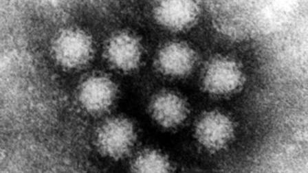 ** FILE ** This undated Negative-stain Transmission Electron Microscopy image, provided by the U.S. Environmental Protection Agency EPA, shows a Norovirus, also known as the Norwalk Virus. Norovirus is a genus of viruses of the family Caliciviridae. Recent scientific findings reveal that the genus causes around 50 percent of all gastroenteritis around the world. (AP Photo/F.P. Williams, U.S. EPA)
