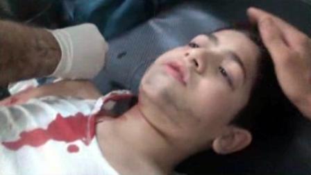 In this frame grab taken from AP Television, an injured child lies on a hospital bed as hes attended to after being wounded in an alleged attack by Syrian troops in the Shaar neighborhood of Aleppo, Syria, Friday, Aug. 3, 2012.