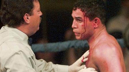 FILE - In this Jan. 16, 1996 file photo, referee Jorge Alfonso, left, looks over a cut on the forehead of IBC Welterweight boxing champ Hector Macho Camacho during the second round of his title bout with Sal Lopez from New Jersey, in Ft. Lauderdale, Fla. Camacho, a boxer known for skill and flamboyance in the ring, as well as for a messy personal life and run-ins with the police, has died, Saturday, Nov. 24, 2012, after being taken off life support. He was 50. (AP Photo/Hans Deryk, File)