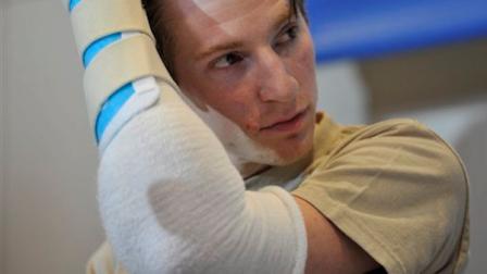 Retired Infantryman Brendan M. Marrocco uses his transplanted arm to brush his hair back during a news conference Tuesday, Jan. 29. 2013 at Johns Hopkins hospital in Baltimore. Marrocco received a transplant of two arms from a deceased donor after losing all four limbs in a 2009 roadside bomb attack in Iraq.