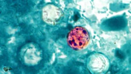 In this image provided by the Centers for Disease Control and Prevention, a photomicrograph of a fresh stool sample, which had been prepared using a 10% formalin solution, and stained with modified acid-fast stain, reveals the presence of four Cyclospora cayetanensis oocysts in the field of view. (AP Photo/Centers for Disease Control and Prevention)