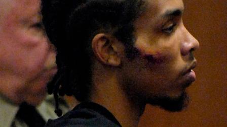 Demario James Atwater of Durham appears for his first bail arraignment in Hillsborough, N.C., Wednesday, March 12, 2008. He had an obvious abrasion on his right cheek. (AP Photo/Sara D. Davis)