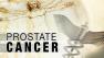 Don't wait on your prostate