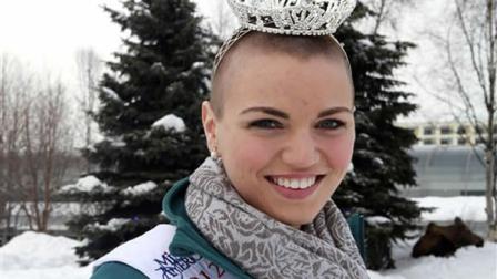 Miss Chugiak-Eagle River Debbe Ebben poses for a photo on Wednesday, March 14, 2012, in Town Square Park in Anchorage, Alaska, as a moose lies near a tree in the background . Ebben, who will compete for the title of Miss Alaska in June, had her head shaved to raise money for the St. Baldricks Foundation, which gives grants for child cancer research. (AP Photo/Dan Joling)