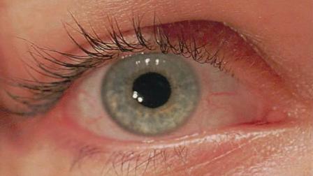 Human eye