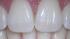 Teeth